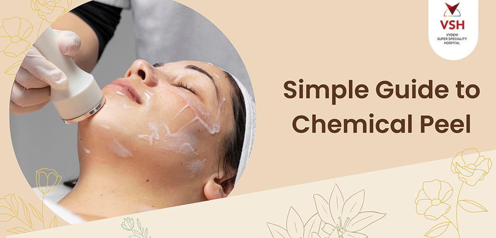 Simple Guide to Chemical Peel