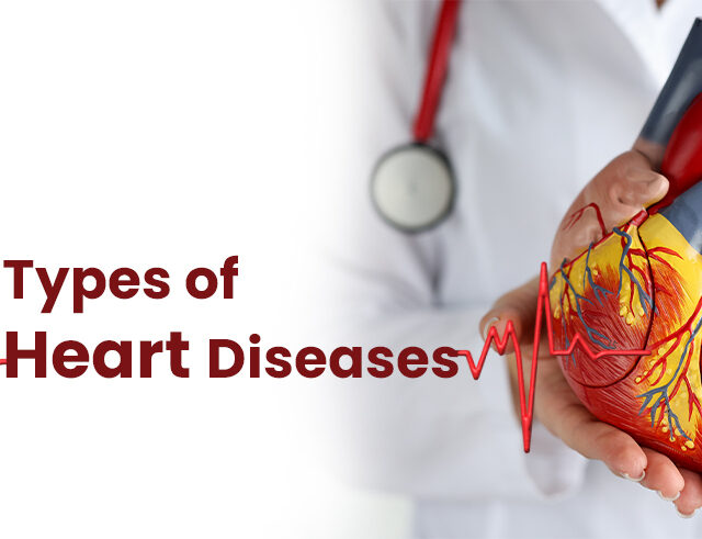 Types of Heart Diseases: List of Most Common Heart (Cardiovascular) Diseases 