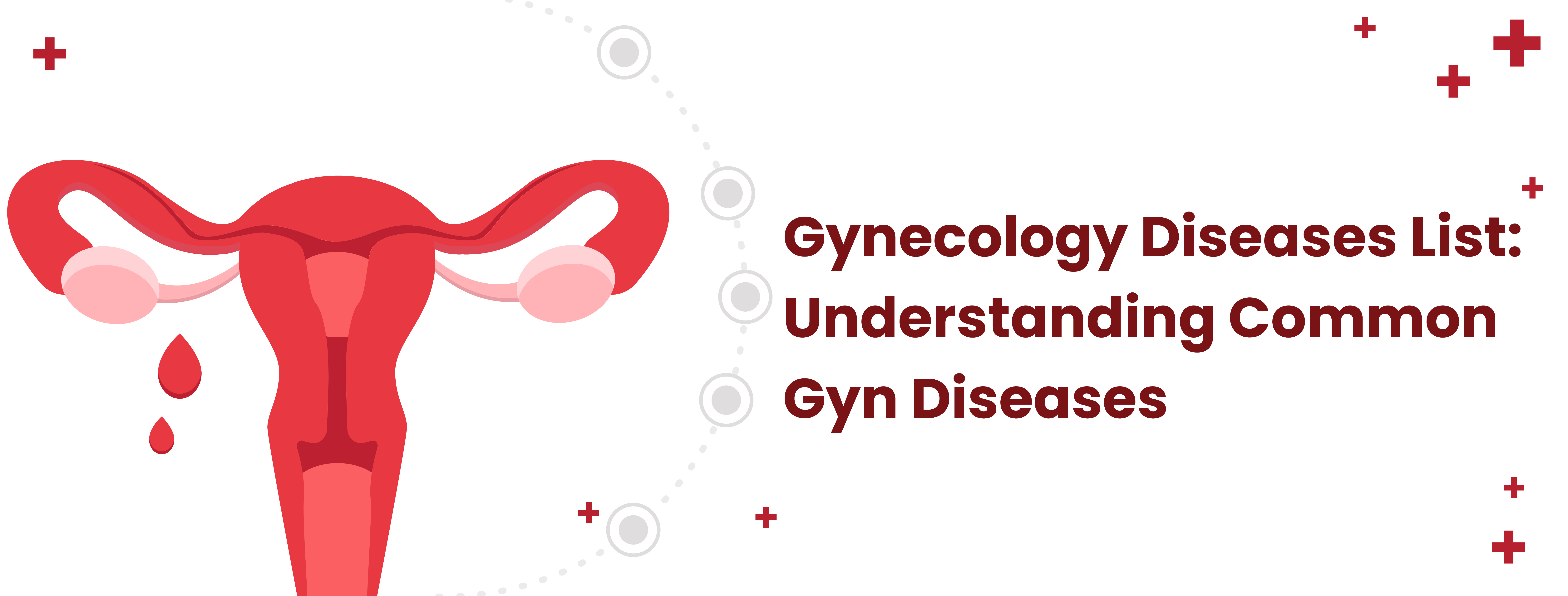 Gynecology Diseases List: Understanding Common Gyn Diseases
