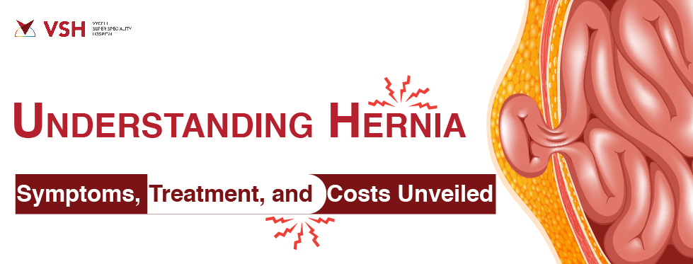 Hernia: Symptoms, Treatment, and Costs Unveiled
