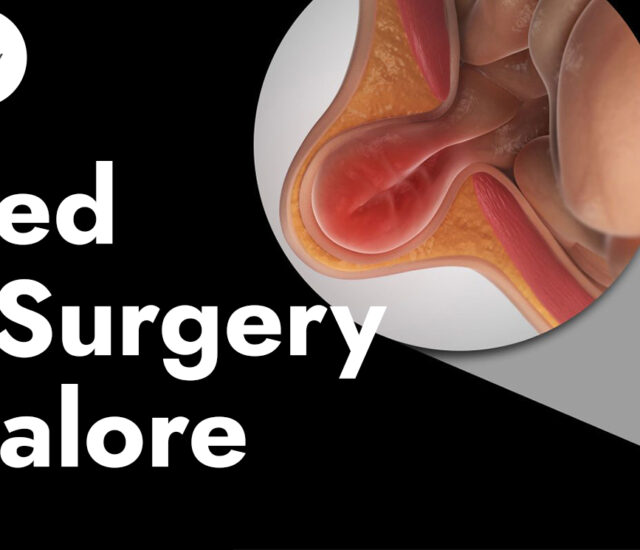 Hernia Surgery Doctors in Bangalore