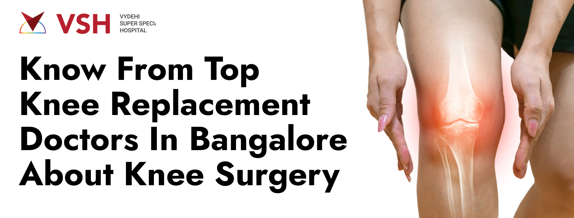 Know From Top Knee Replacement Doctors In Bangalore About Knee Surgery