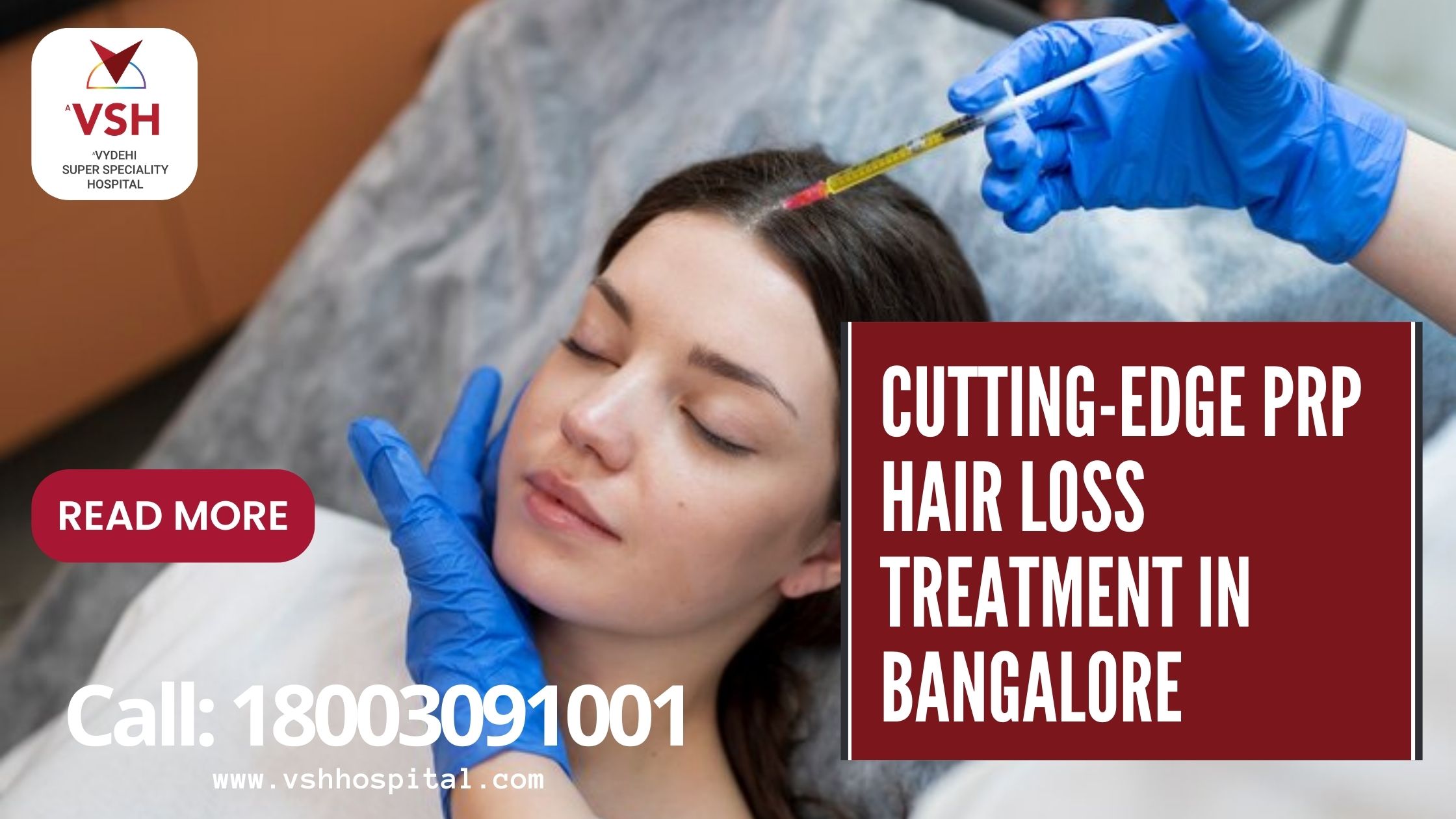 Nourish Your Hair: PRP Treatment for Hair Loss in Bangalore by VSH Hospital