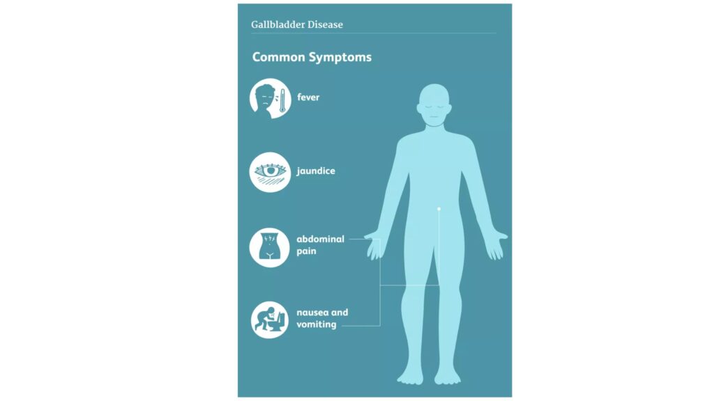  Gallbladder Distress Symptoms