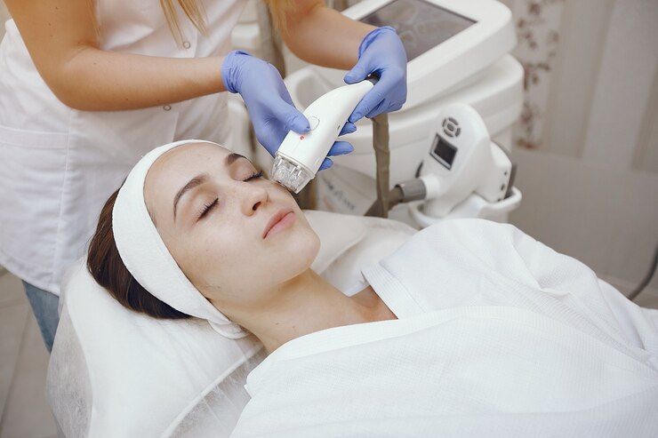 A close-up image of a laser treatment being applied to a patient's face for acne removal, showcasing the advanced technology.
